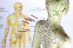 24-Day Course in TCM Acupuncture